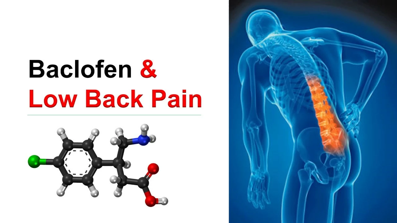 Baclofen for Syringomyelia: Can It Help Manage Pain?
