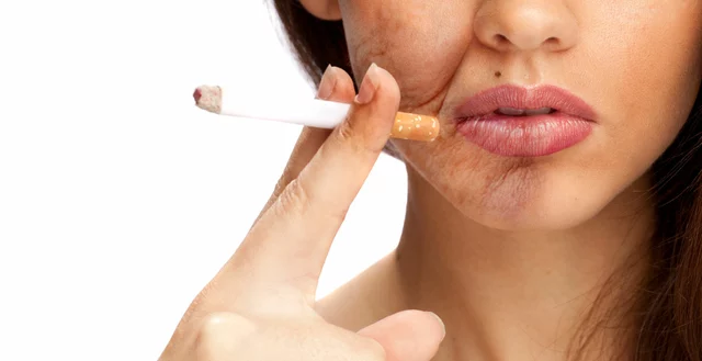 Dermatitis Herpetiformis and Smoking: Tips for Quitting